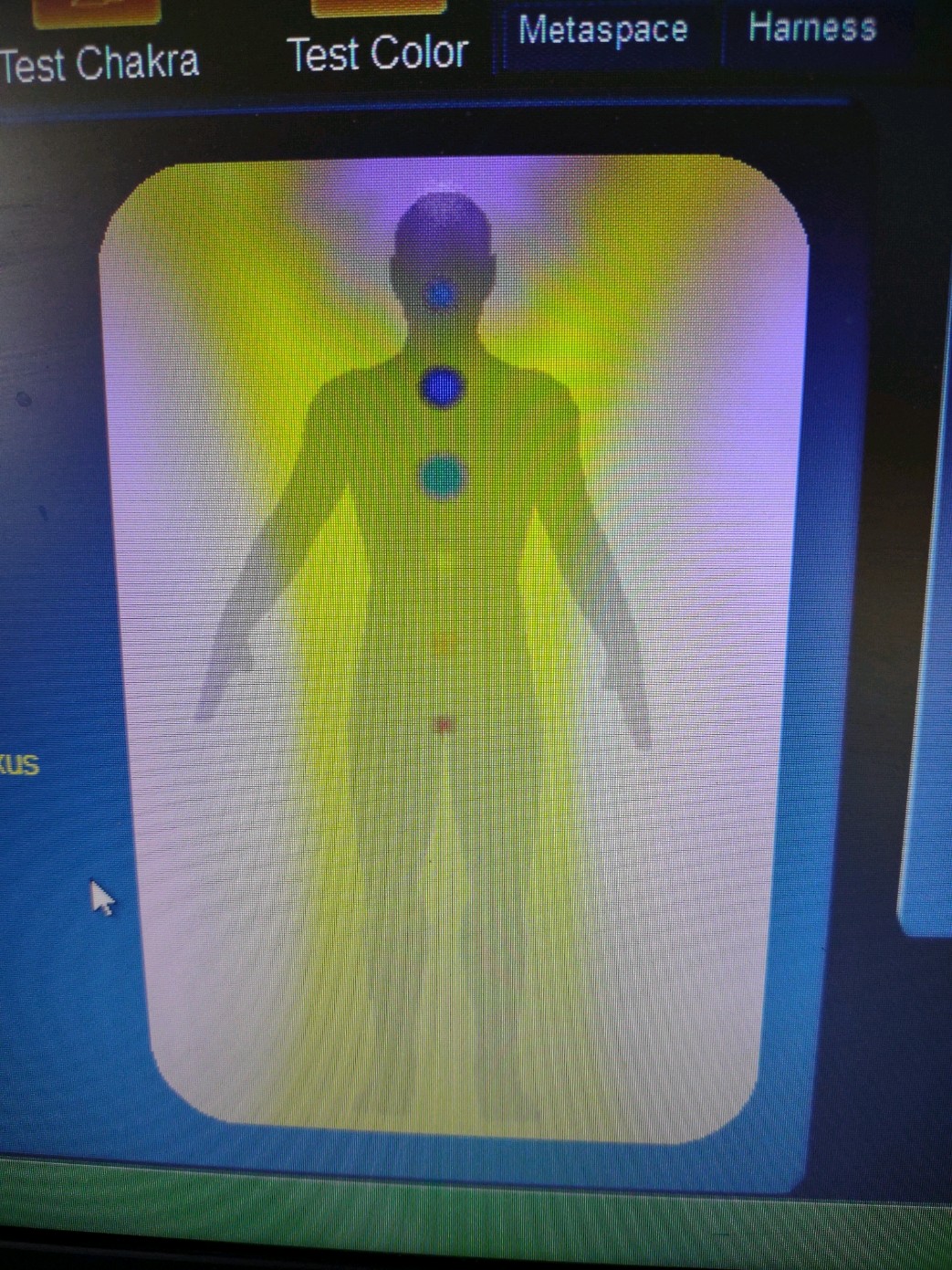 Before L.I.F.E. System Biofeedback Treatment