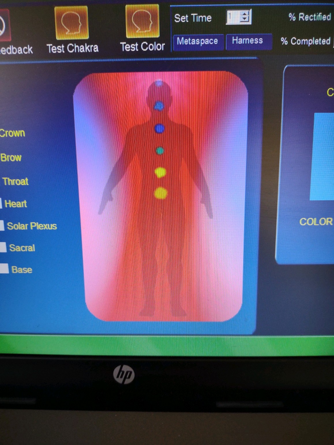 After L.I.F.E. System Biofeedback Treatment